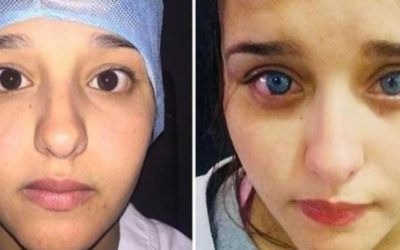Marokko: vrouw verandert definitief van oogkleur