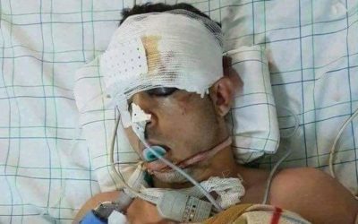 Imzouren: Dialysecentrum voor het einde van het jaar klaar