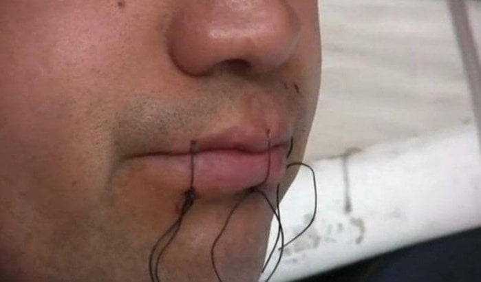 Marokkaan naait lippen dicht om uitzetting te voorkomen in Frankrijk
